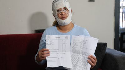  Adana'da 'prenses cilt bakımı' yaptırmak için güzellik merkezine giden